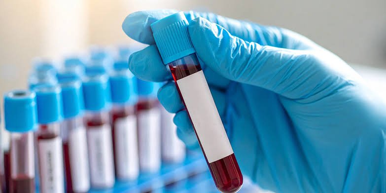 Blood Test at Home